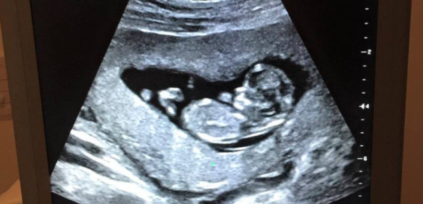 Buble ultrasound